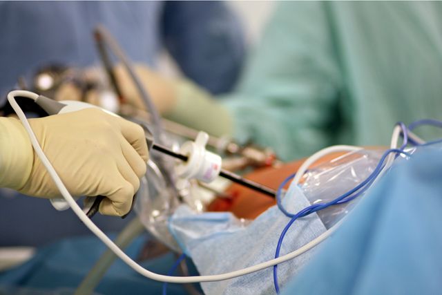 Лапароскопічні операції в Ужгороді: мінімум травматизму при високій ефективності лікування - фото 458520