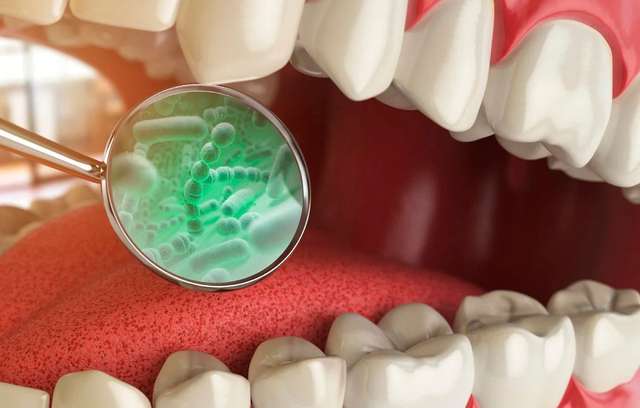 Основні причини потемніння зубної емалі - фото 458585