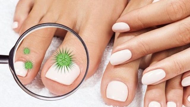 Основні способи профілактики ураження нігтів грибком - фото 460447