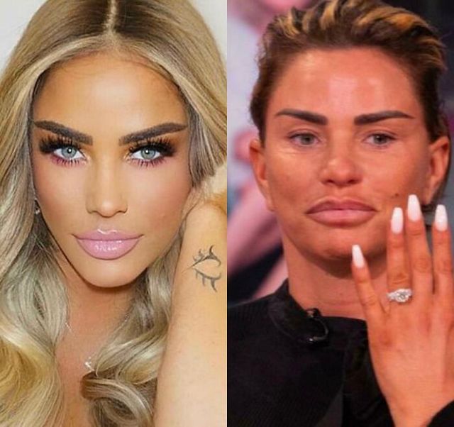 Забагато фотошопу: фото надто ідеальних людей, які шокують - фото 461862