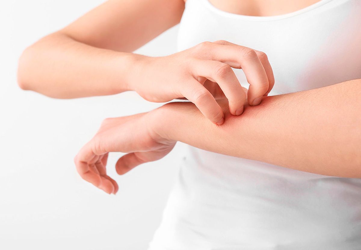 Зуд від комарів - фото 1