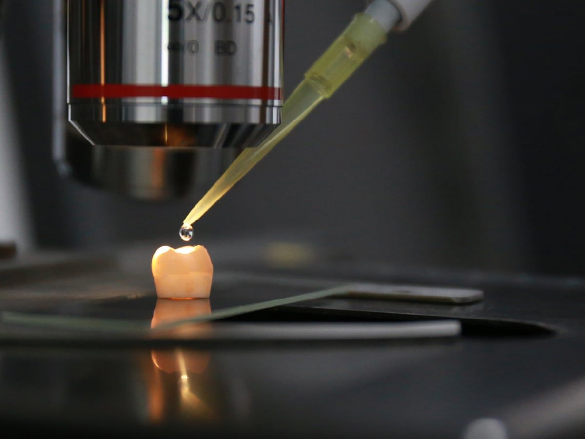 Смачно і корисно: у США винайшли цукерки для відновлення зубів