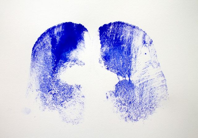 Британські митці зібрали виставку, яка присвячена сідницям: дивіться фото робіт - фото 470228