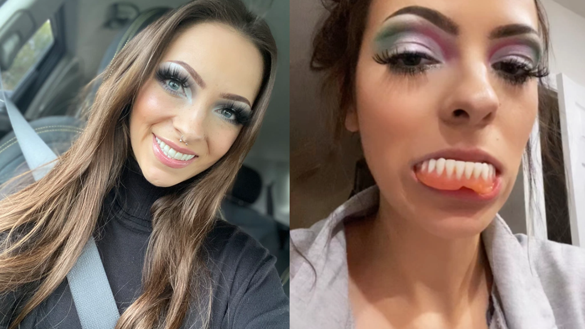 Історія юної американки, яка у 24 роки залишилася без жодного зуба - фото 1