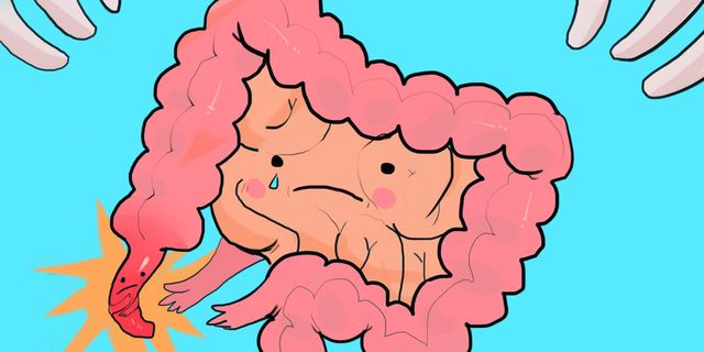 Симптоми апендициту - фото 475593