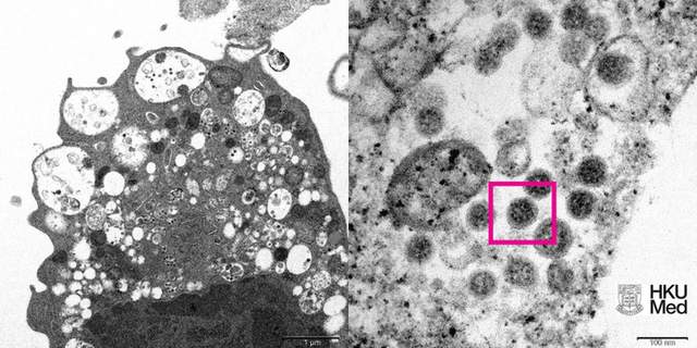 Вчені показали, як виглядає штам коронавірусу Омікрон - фото 487852