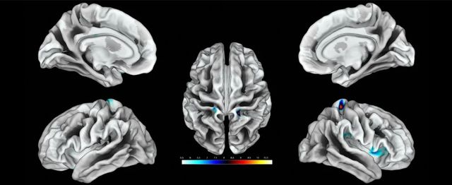Науковці виявили у мозку жінки область, яка реагує на стимуляцію клітора - фото 489319