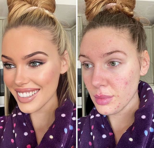 Що ховається за ідеальними фото: дівчина шокувала знімками до і після - фото 491313