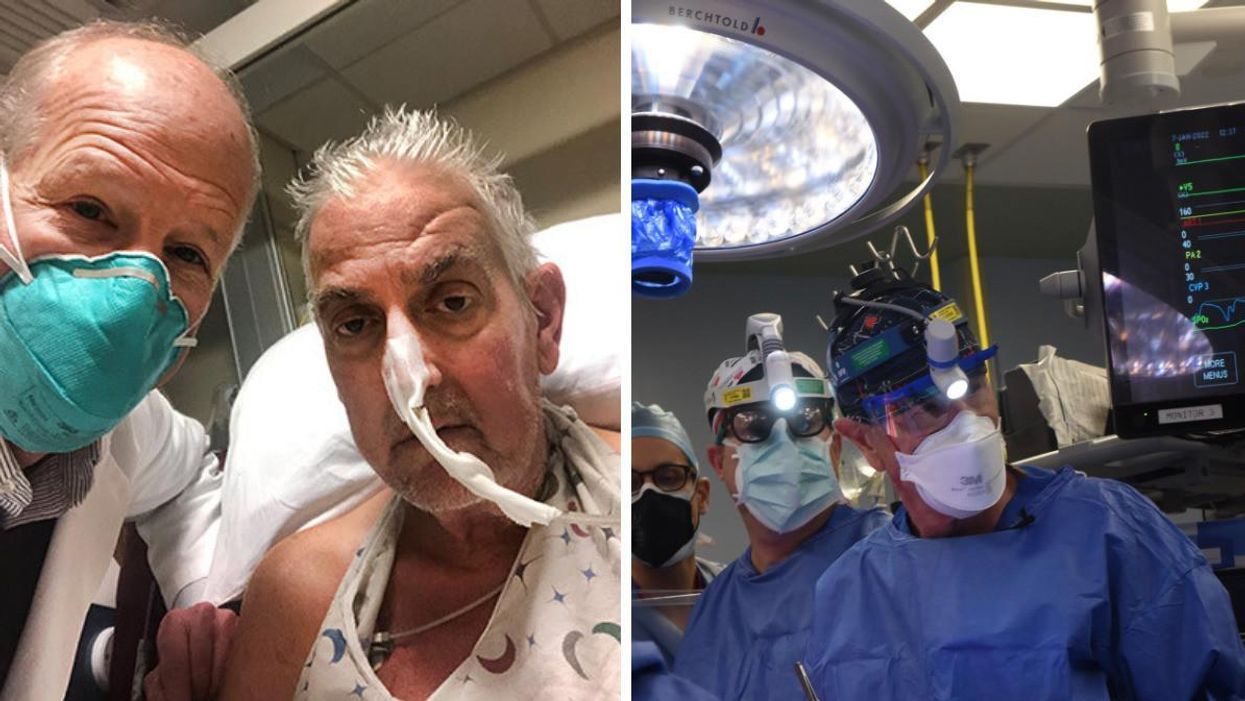 Унікальна операція: людині вперше успішно пересадили серце свині