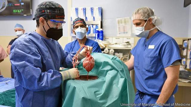 Унікальна операція: людині вперше успішно пересадили серце свині - фото 491936