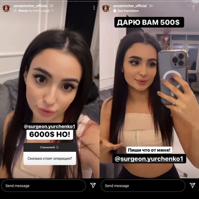 За 6 тисяч доларів: Анна Трінчер вперше показала збільшені груди - фото 492986