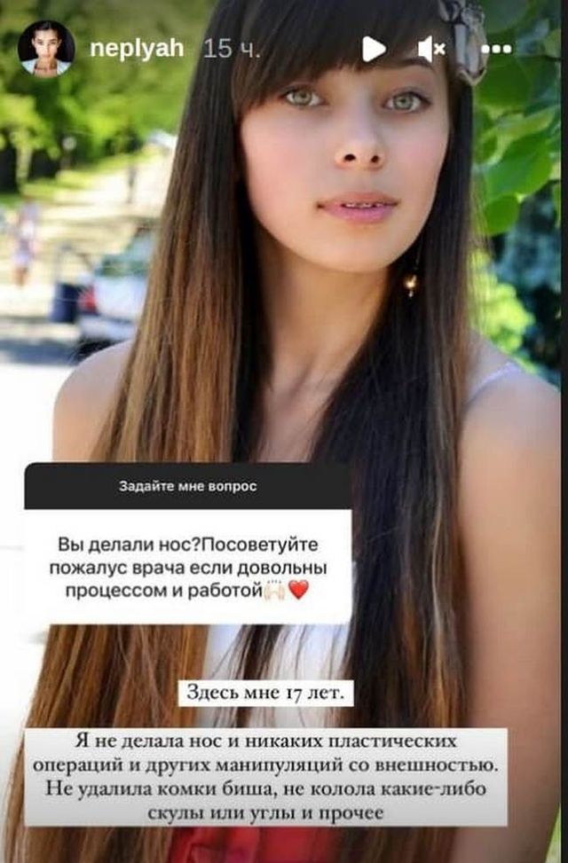 'Ви зробили ніс?': міс Україна Всесвіт Анна Неплях показала себе у 17 років - фото 494688