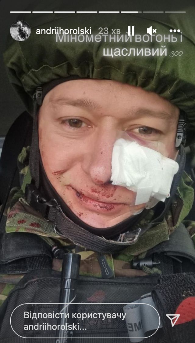 Лідер гурту Бумбокс Андрій Хливнюк потрапив під мінометний обстріл: отримав поранення - фото 501862