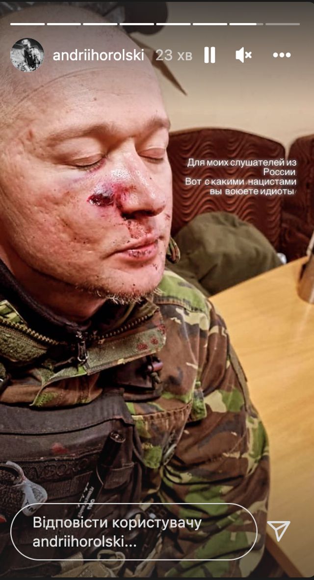 Лідер гурту Бумбокс Андрій Хливнюк потрапив під мінометний обстріл: отримав поранення - фото 501863