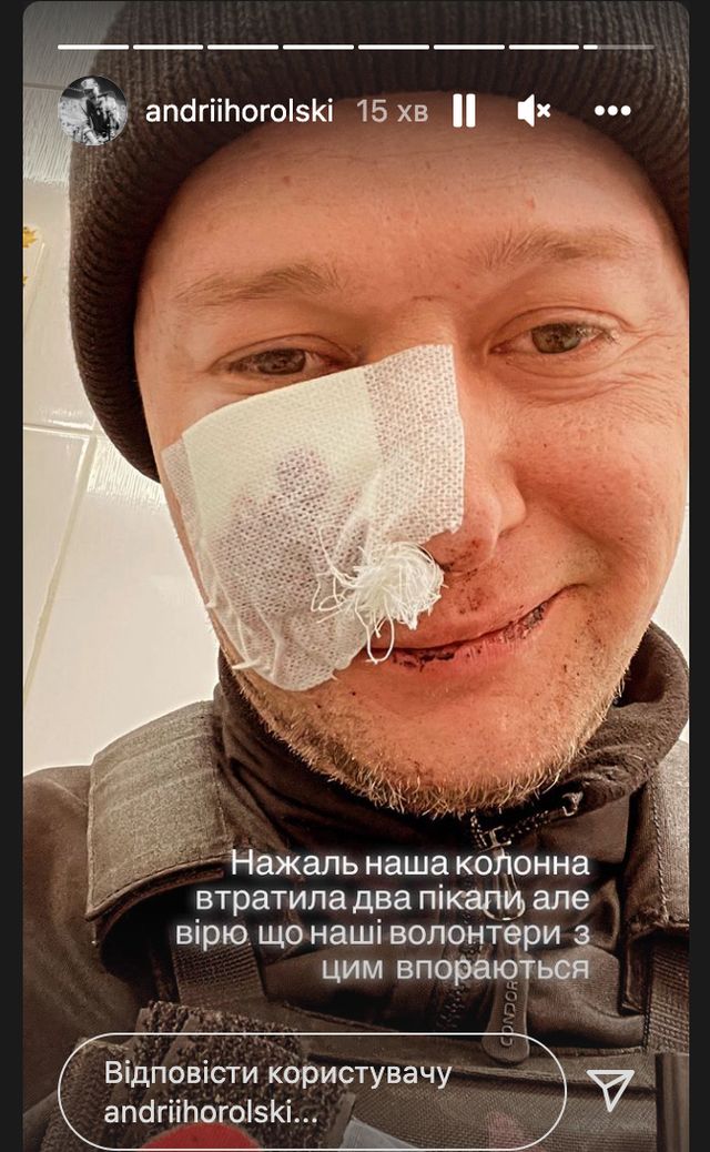 Лідер гурту Бумбокс Андрій Хливнюк потрапив під мінометний обстріл: отримав поранення - фото 501864