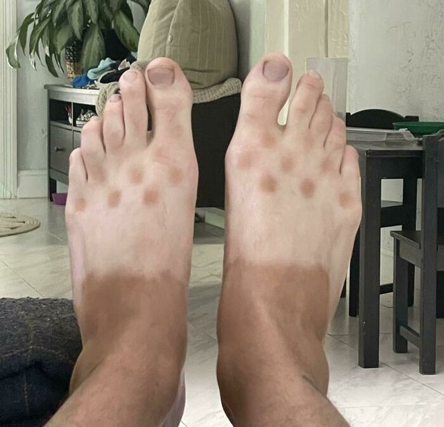 Skintoodeep - фото 510920