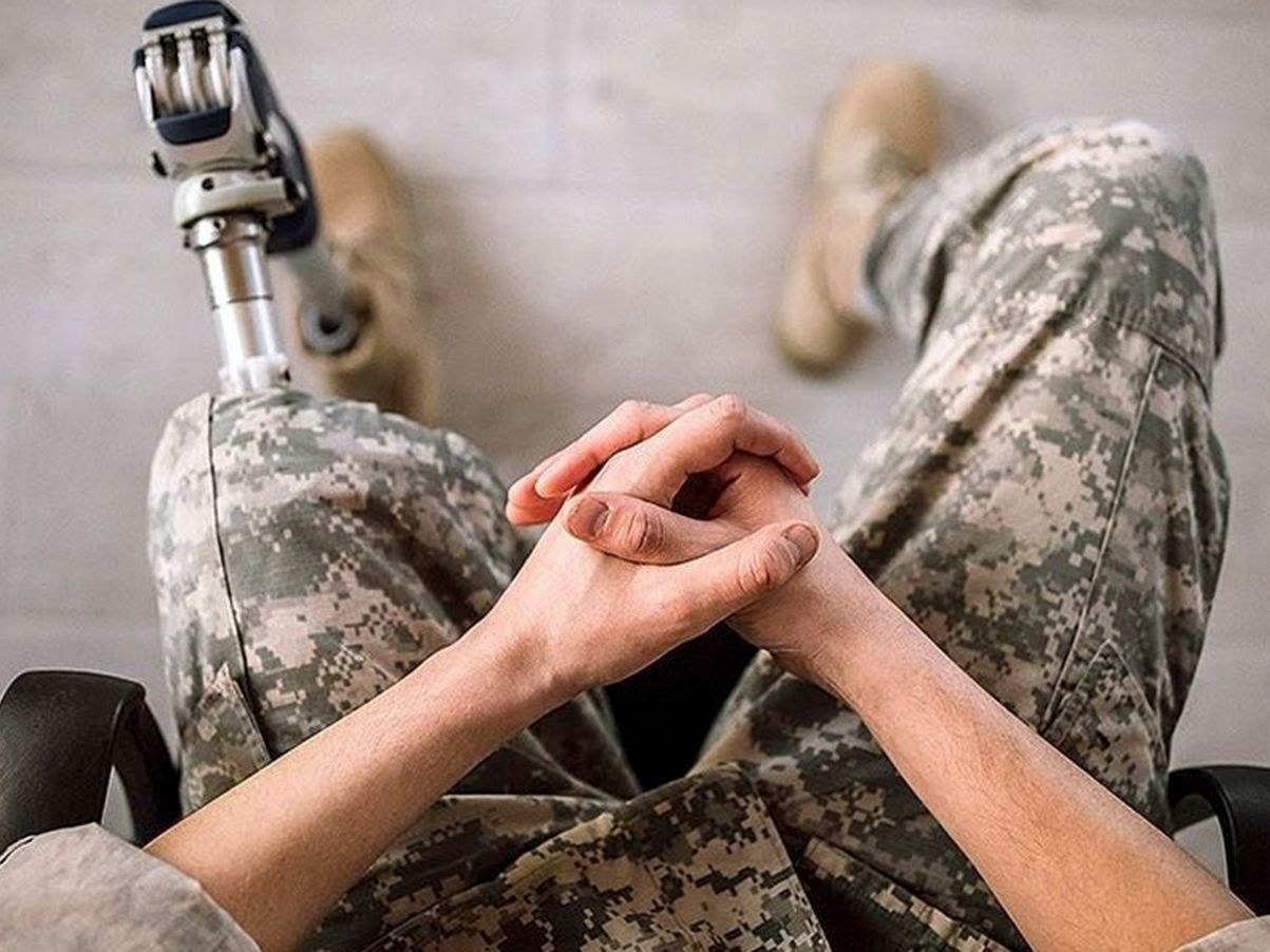 Українським військовим спростили виїзд на лікування за кордон