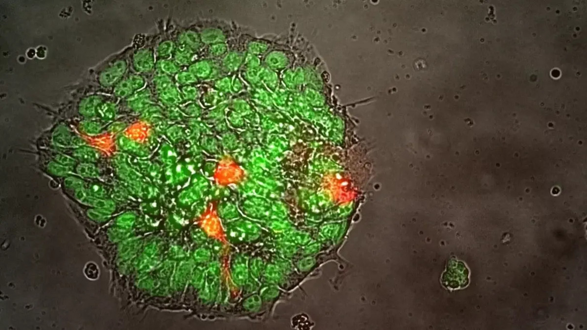 Cтовбурові клітини - фото 1
