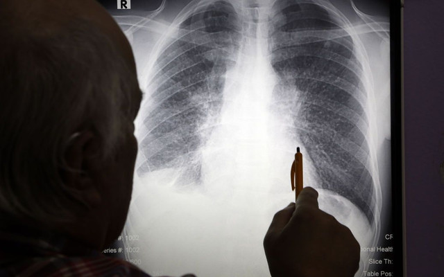 Ілюстративне фото - фото 528208