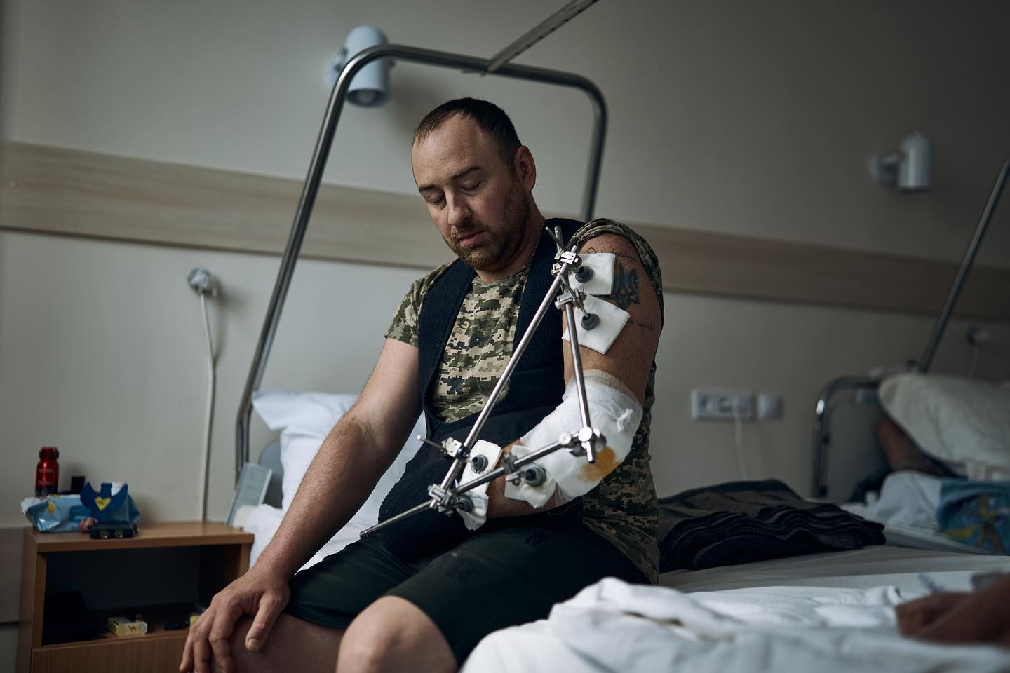 З початку широкомасштабної війни до 50 тисяч українців пережили ампутацію – WSJ