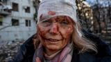 International Photography Awards нагородили американця за фото пораненої жінки з Чугуєва