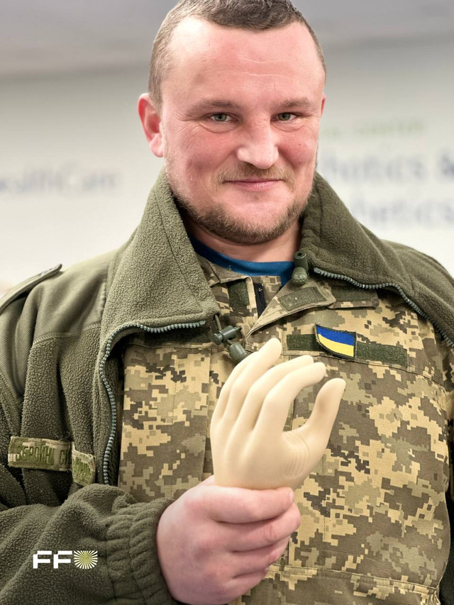 Український захисник Сергій Дудік розповів, як живе після протезування у Вашингтоні - фото 533574