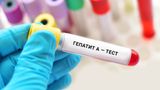 Гепатит А в Україні – чому саме у Вінниці спалахнула хвороба
