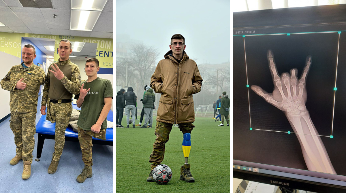 "Життям можна насолоджуватися": як живе захисник після протезування у Вашингтоні - фото 1