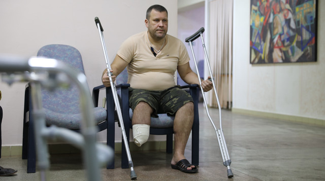 'Донька сказала — мені личить': як військовий вернувся до цивільного життя після ампутації - фото 534941