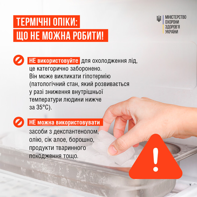 Термічні опіки: у МОЗ розповіли, що можна робити, а що категорично – ні - фото 536304