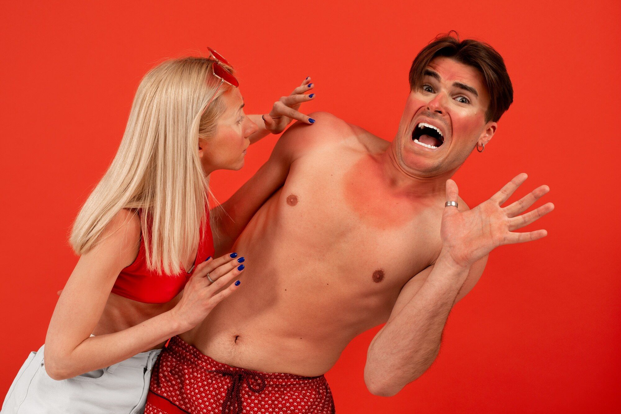 Сонячні опіки можуть наробити чимало проблем - фото 1