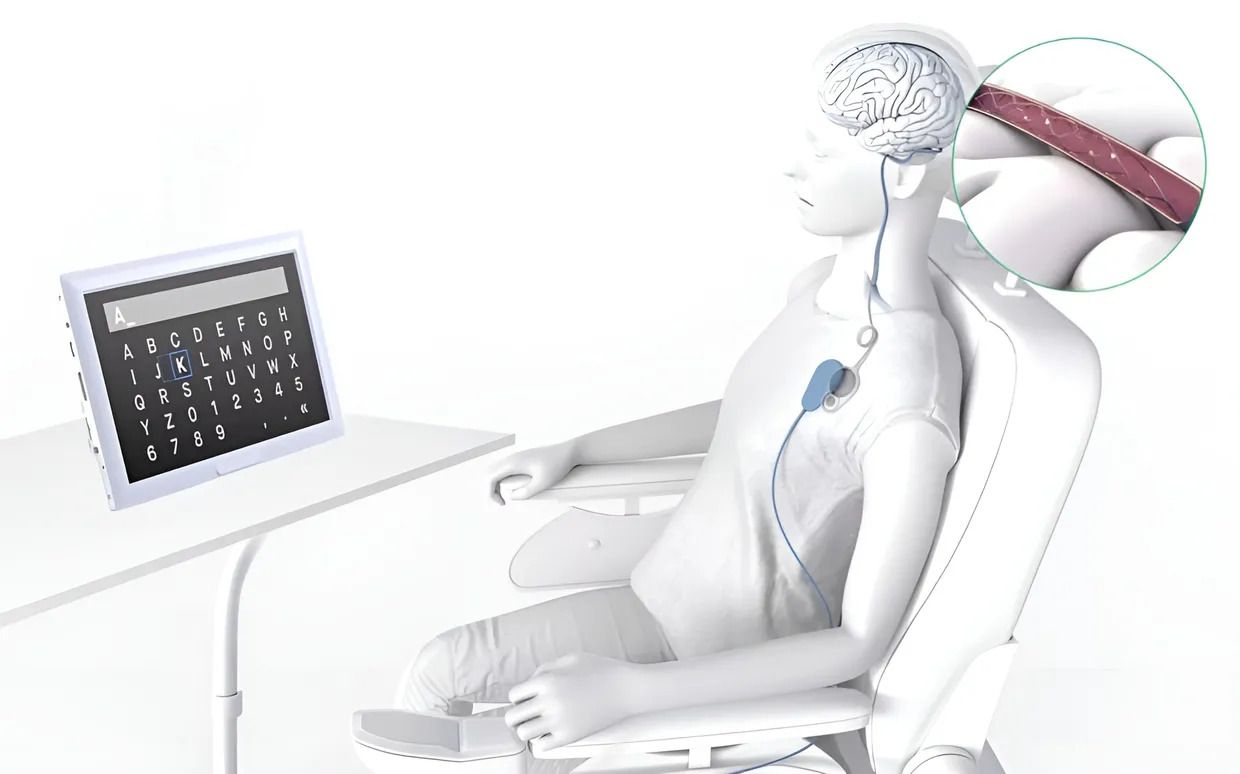 ChatGPT у голові - фото 1