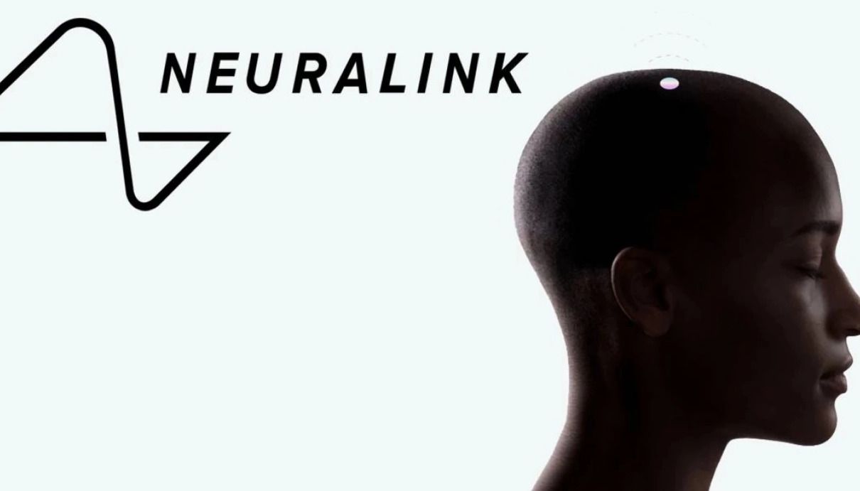 Neuralink - фото 1