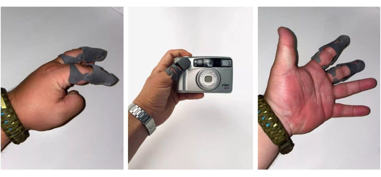 3D-протези для відновлення пальців - фото 1