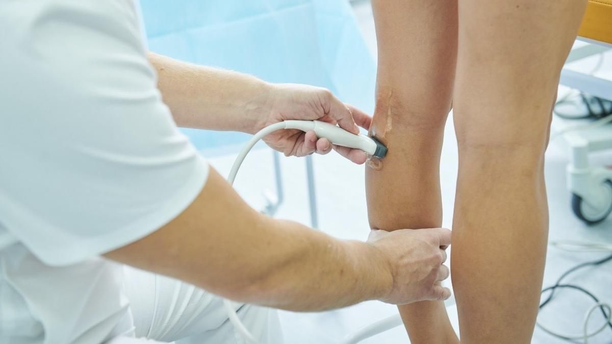 Коли варто робити УЗД нижніх кінцівок: основні причини - фото 1