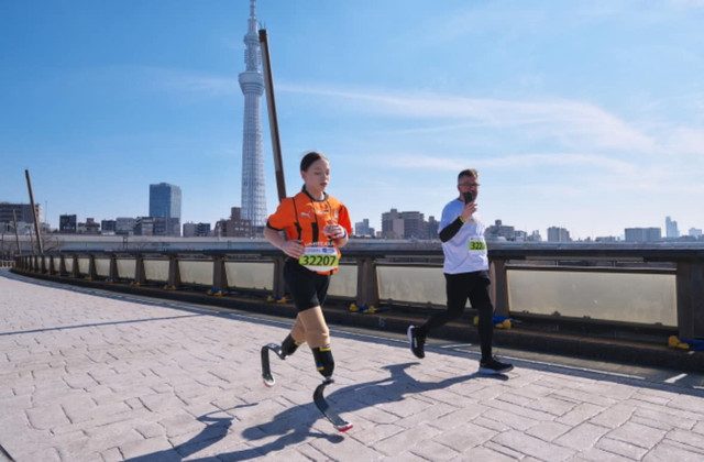 13-річна українка пробігла 5 кілометрів на протезах- фото 552590