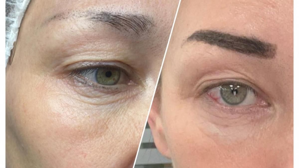 Топ-3 косметологічні процедури для шкіри 40+ за порадами експертів Barb - фото 1