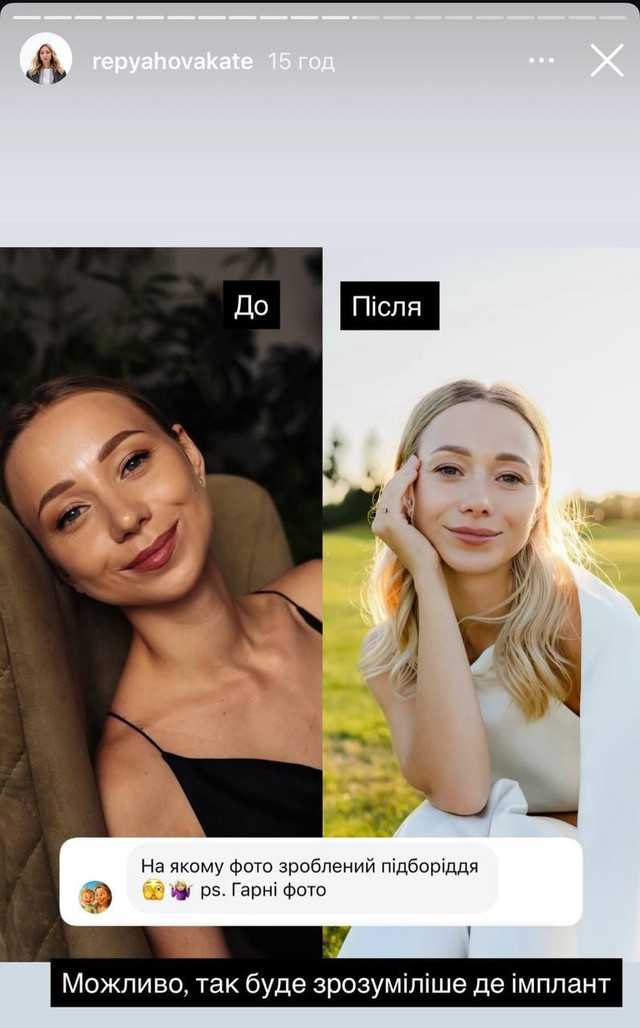 Дружина Віктора Павліка зізналася у невдалій пластичній операції на підборідді - фото 568869