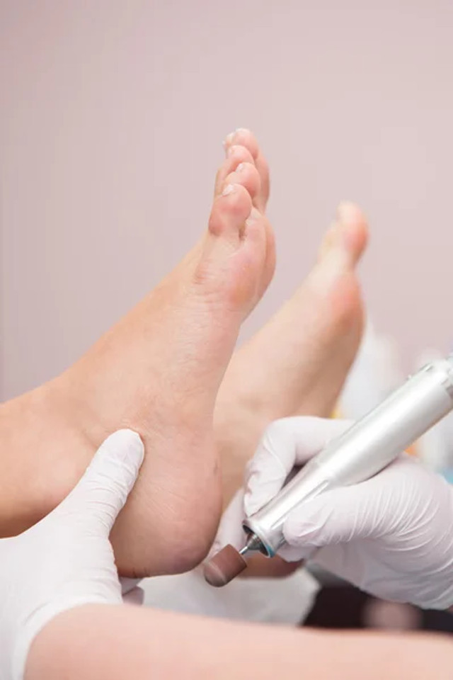 Педикюр після 40: як зберегти охайний вигляд стоп без зайвих зусиль - фото 590225