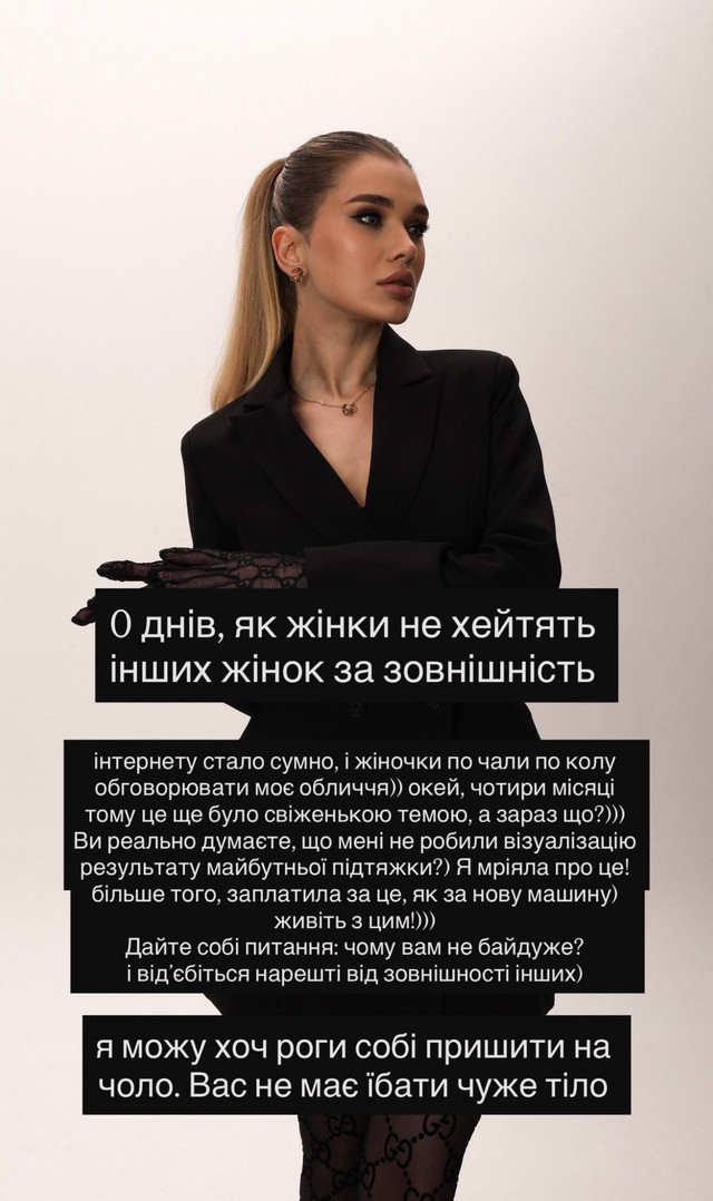 Саша Бо жорстко відповіла хейтерам після підтяжки обличчя – 'Живіть з цим' - фото 597978