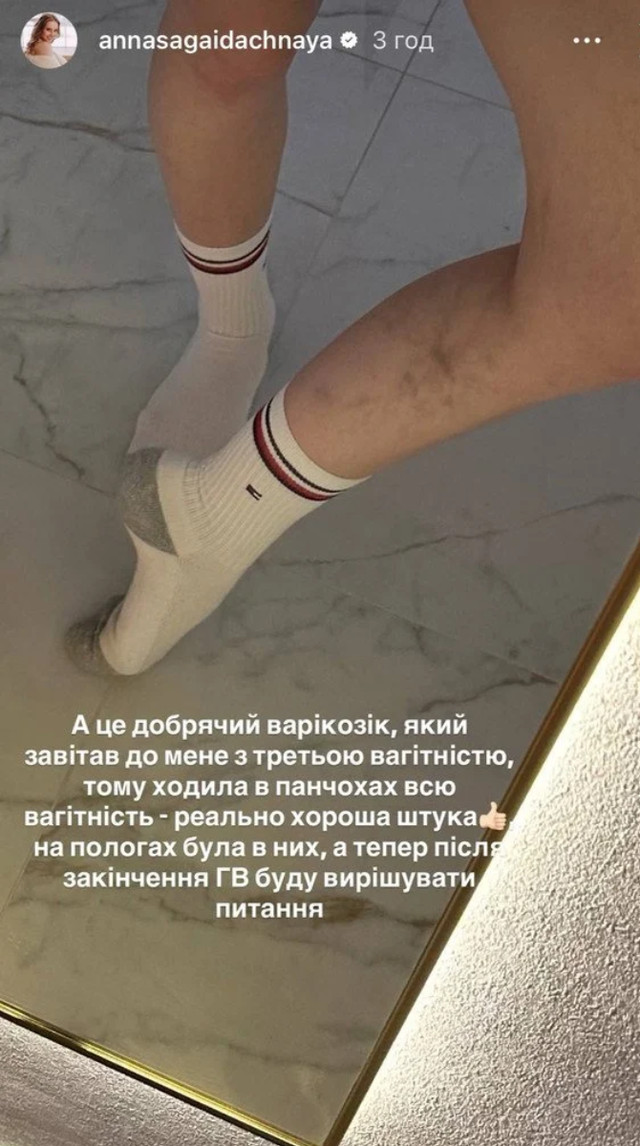 Анна Сагайдачна розсекретила вагу після третіх пологів: фото фігури без прикрас - фото 606705