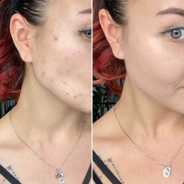 Як знайти баланс між корекцією тону і природним виглядом - фото 611214