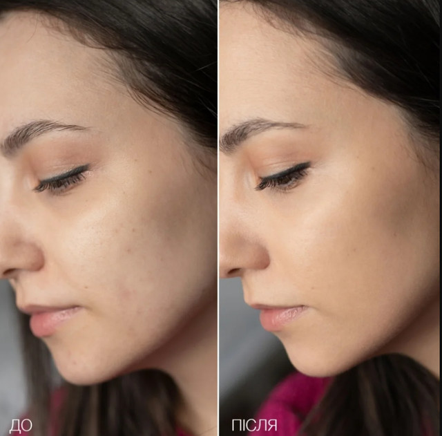 Чому легкі тональні засоби стали популярнішими за щільні - фото 611219